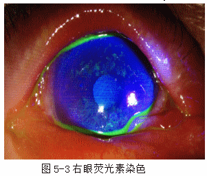 ZY016_20_4.gif